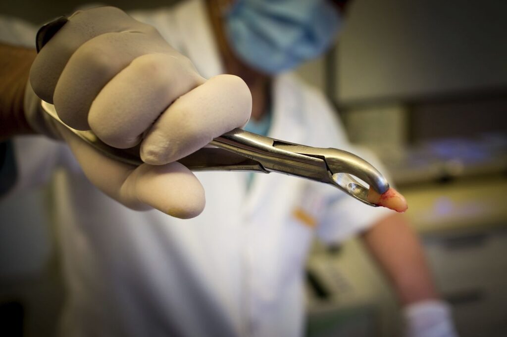 Free tooth extraction image